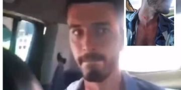 Turista en Cartagena por poco termina degollado al ser víctima de robo de una cadena 