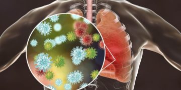 Infecciones respiratorias agudas: Síntomas, prevención y cuidados