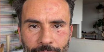 Juan Pablo Raba, reconocido actor de cine y televisión, víctima de robo y agresión en Bogotá
