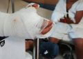 Alarmante aumento de casos de quemados con pólvora en la región Caribe durante la temporada decembrina