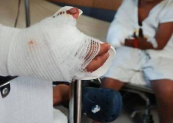 Alarmante aumento de casos de quemados con pólvora en la región Caribe durante la temporada decembrina