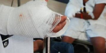 Alarmante aumento de casos de quemados con pólvora en la región Caribe durante la temporada decembrina