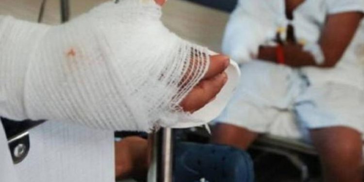 Alarmante aumento de casos de quemados con pólvora en la región Caribe durante la temporada decembrina