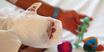 Primer día de diciembre: ya van seis quemados con pólvora, entre ellos dos menores