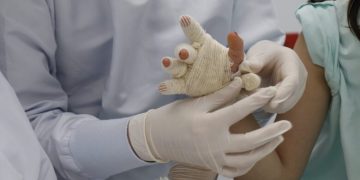 3 quemados con pólvora en Nochebuena barranquillera: 2 son menores de edad