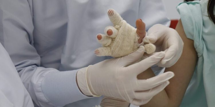 3 quemados con pólvora en Nochebuena barranquillera: 2 son menores de edad