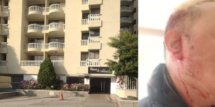 Con cacha de revolver, cliente moroso hiere a operario de Air-e