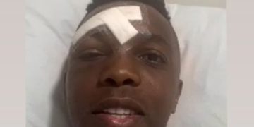 Édison Toloza reaparece tras grave accidente en moto: se mantiene “estable”