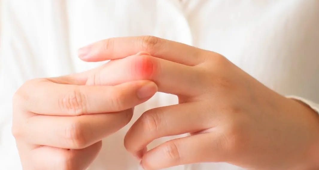 Lupus: “entendiendo la enfermedad y aprendiendo a vivir con ella”