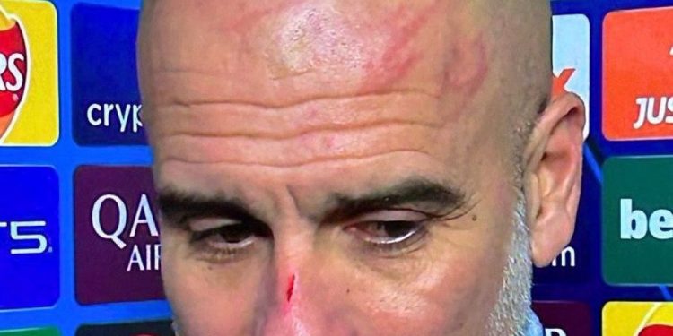 Guardiola apareció con lesiones tras el empate que sufrió el City luego de ir ganando 3-0