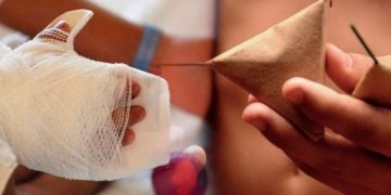 Noche de Navidad deja 3 heridos por pólvora: Distrito refuerza llamado a prevenir accidentes y lesionados