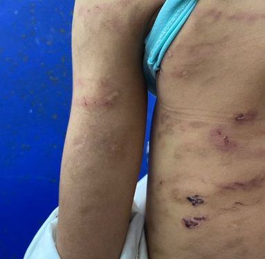 Menor de edad ingresó a clínica tras sufrir maltrato físico y psicológico en su hogar en Buenaventura