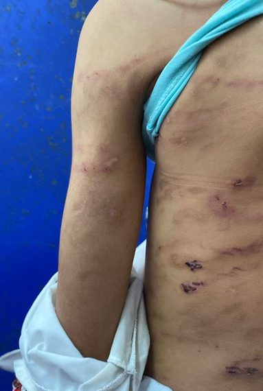 Menor de edad ingresó a clínica tras sufrir maltrato físico y psicológico en su hogar en Buenaventura