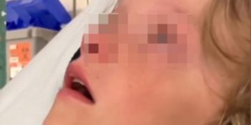 Niño dice ver a su padre fallecido y a Jesús tras accidente en patineta: “Te ves hermoso, papá”