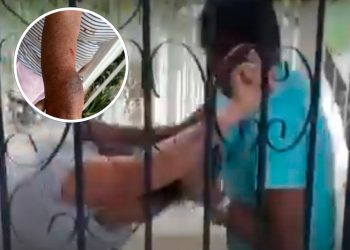 Brutal ataque familiar en Valledupar: mujer de la tercera edad fue golpeada por su sobrino tras intentar llevarse a una menor bajo custodia legal