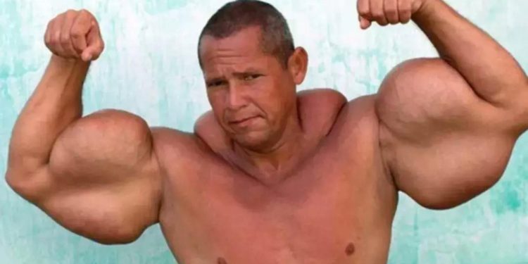 Adiós a ‘Popeye’: murió el fisicoculturista brasileño famoso por sus bíceps de 73 cm