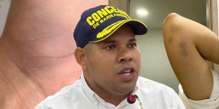 Fiscalía ordena captura de concejal Alexis Castillo por presunta violencia intrafamiliar agravada