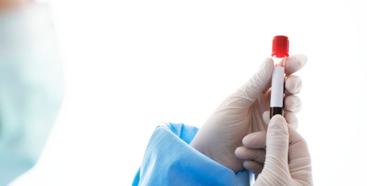 El menor Kevin Acosta fue víctima de la omisión de la Nueva EPS por falta de suministro del medicamento: Procuraduría