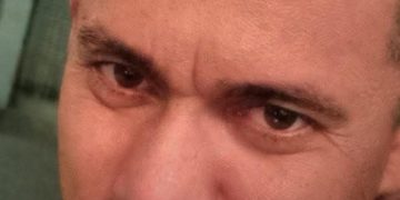 Murió domiciliario herido en atentado en Sabanalarga