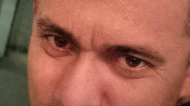 Murió domiciliario herido en atentado en Sabanalarga