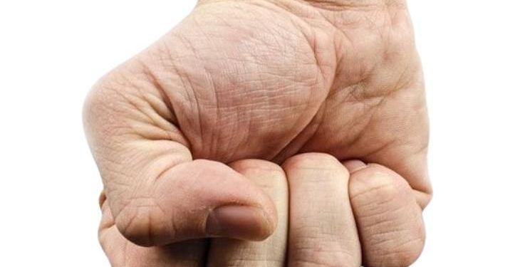 Cargos a concejal Calamar, Guaviare, por presuntas agresiones contra miembros de la Policía Nacional